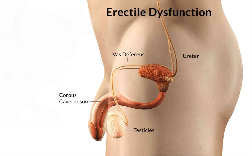 can hernia cause ed