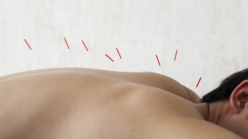 acupuncture for erectile dysfunction